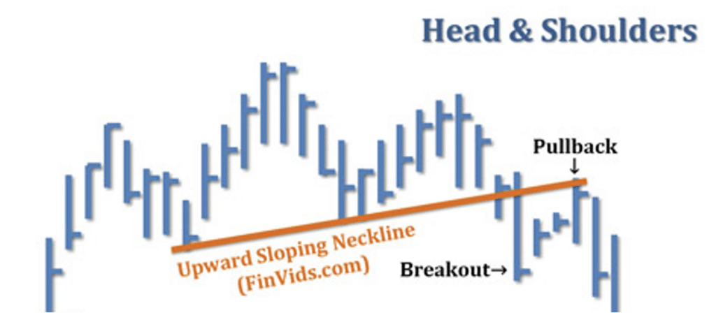 upward-sloping neckline